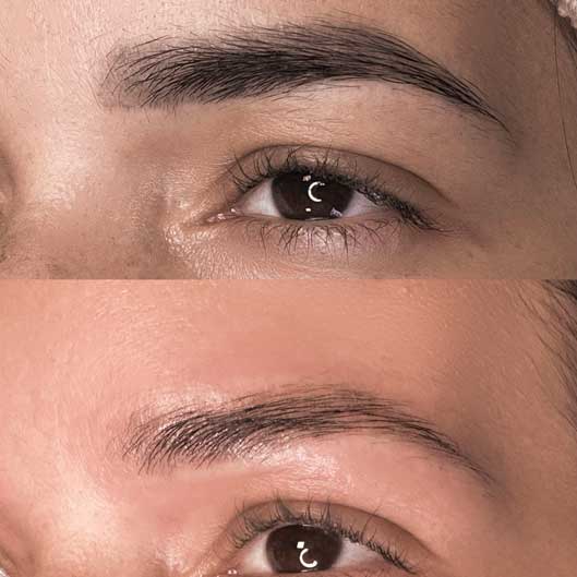 Sobrancelhas, Pele e Lábios em São José do Rio Preto Karol Mafra Beauty Remoção a Laser