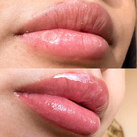 Sobrancelhas, Pele e Lábios em São José do Rio Preto Karol Mafra Beauty Lip Booster