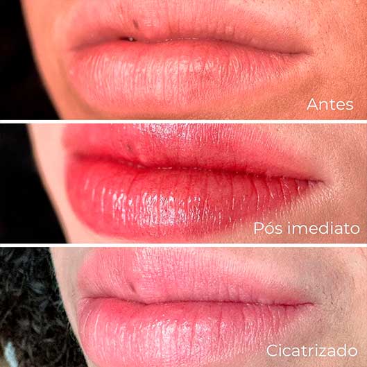 Sobrancelhas, Pele e Lábios em São José do Rio Preto Karol Mafra Beauty Nano Labial