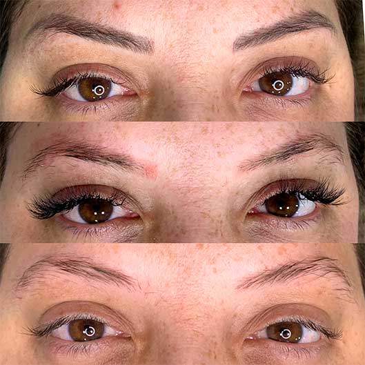 Sobrancelhas, Pele e Lábios em São José do Rio Preto Karol Mafra Beauty Remoção a Laser