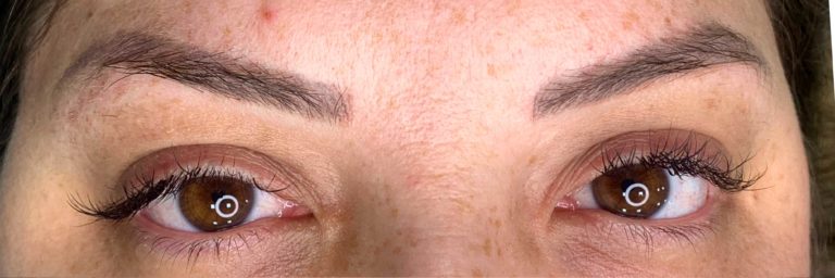 Sobrancelhas, Pele e Lábios em São José do Rio Preto Karol Mafra Beauty Remoção a Laser