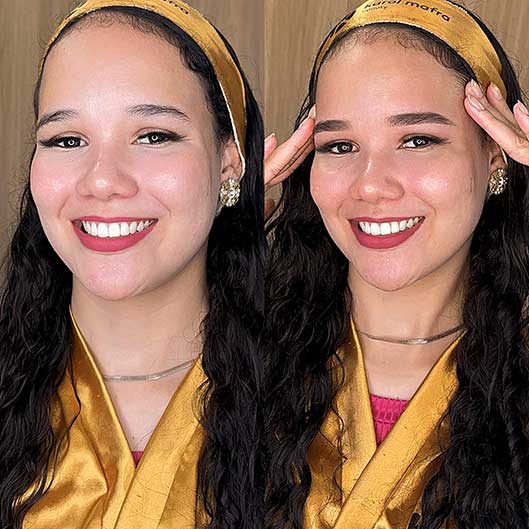 Sobrancelhas, Pele e Lábios em São José do Rio Preto Karol Mafra Beauty Remoção a Laser