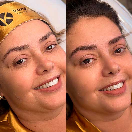Sobrancelhas, Pele e Lábios em São José do Rio Preto Karol Mafra Beauty