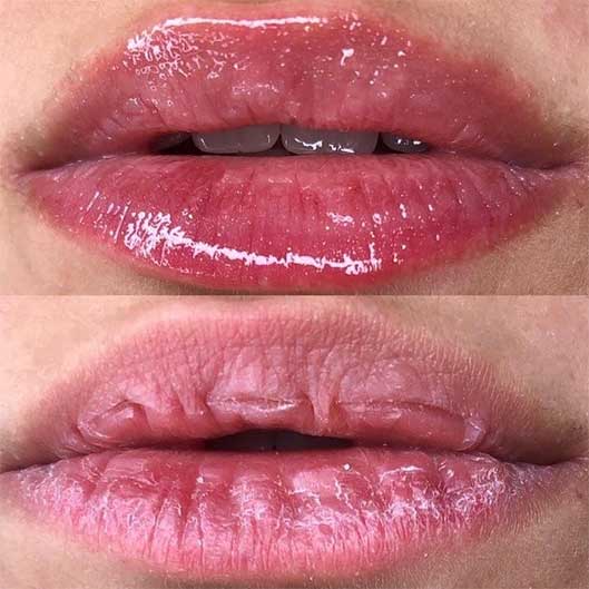 Sobrancelhas, Pele e Lábios em São José do Rio Preto Karol Mafra Beauty Lip Booster