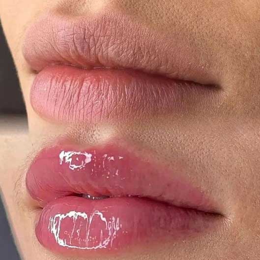 Sobrancelhas, Pele e Lábios em São José do Rio Preto Karol Mafra Beauty Lip Booster