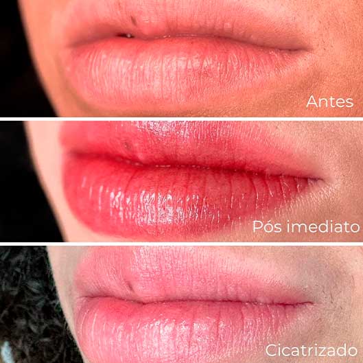 Sobrancelhas, Pele e Lábios em São José do Rio Preto Karol Mafra Beauty Lip Booster