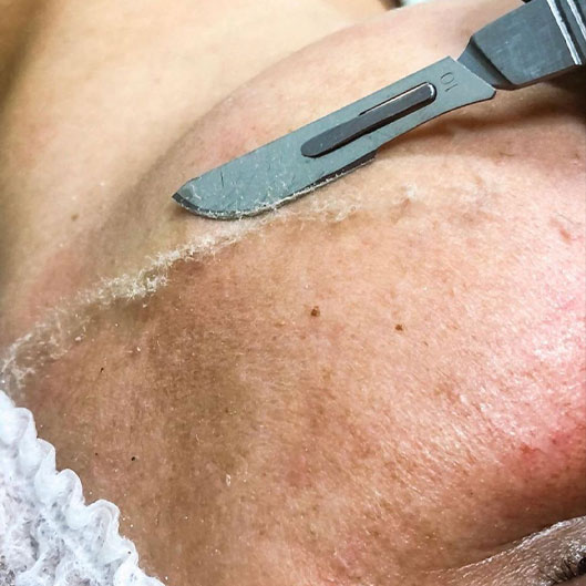 Sobrancelhas, Pele e Lábios em São José do Rio Preto Karol Mafra Beauty