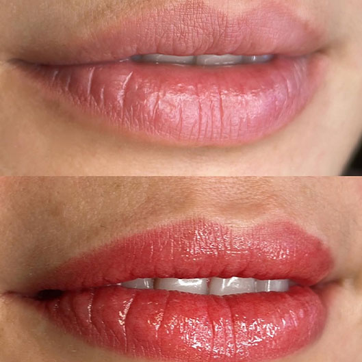 Sobrancelhas, Pele e Lábios em São José do Rio Preto Karol Mafra Beauty Lip Booster